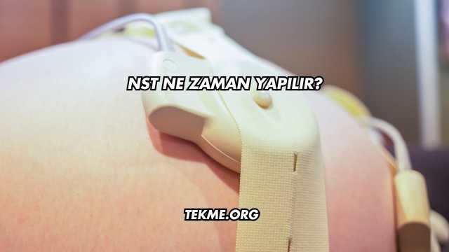 NST Ne Zaman Yapılır?