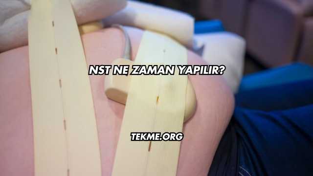 NST Ne Zaman Yapılır?