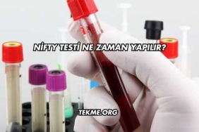 Nifty Testi Ne Zaman Yapılır?