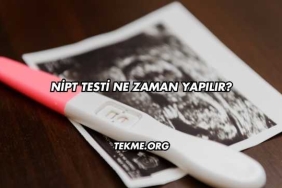 Nipt Testi Ne Zaman Yapılır?