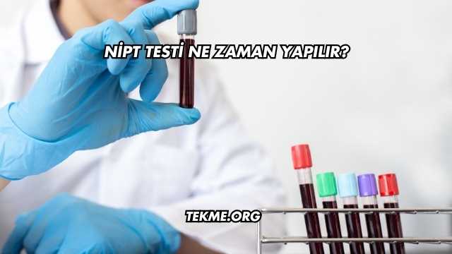 Nipt Testi Ne Zaman Yapılır?