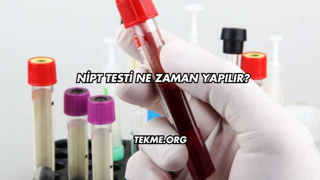 Nipt Testi Ne Zaman Yapılır?