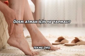 Ödem Atmak İçin Ne Yapmalı?