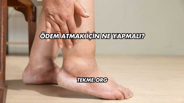 Ödem Atmak İçin Ne Yapmalı?