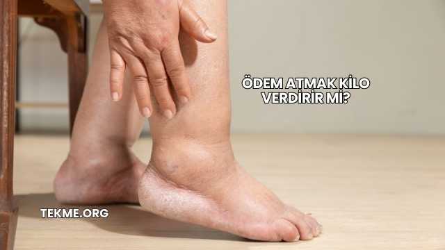 Ödem Atmak Kilo Verdirir mi?