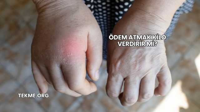Ödem Atmak Kilo Verdirir mi?