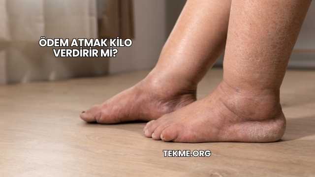 Ödem Atmak Kilo Verdirir mi?