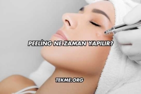 Peeling Ne Zaman Yapılır?