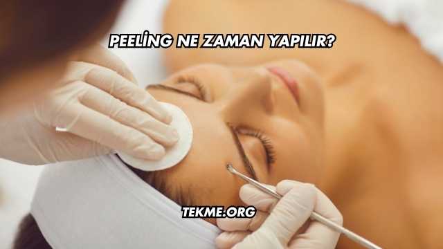 Peeling Ne Zaman Yapılır?