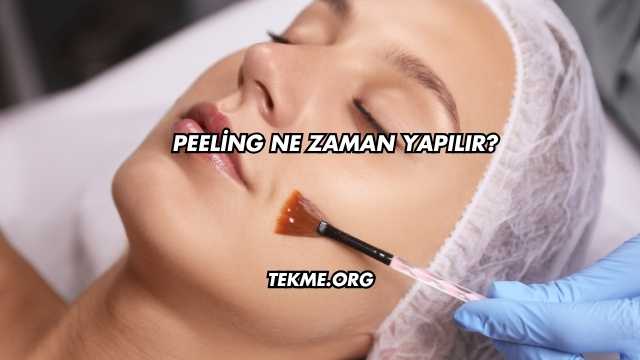 Peeling Ne Zaman Yapılır?