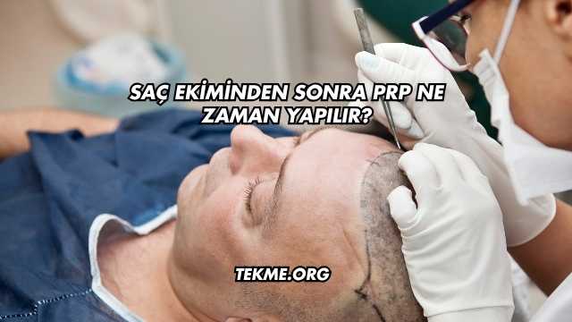 Saç Ekiminden Sonra PRP Ne Zaman Yapılır?