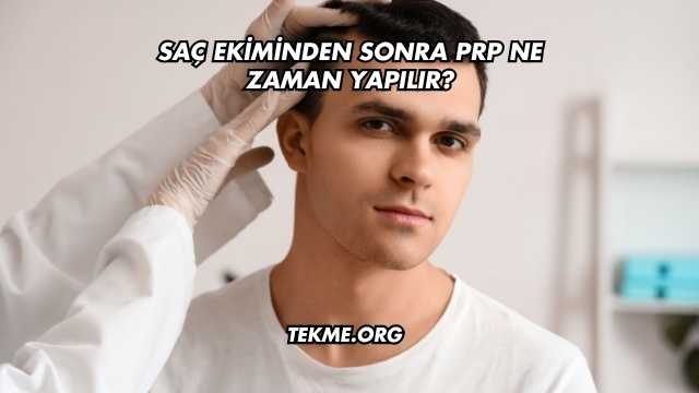 Saç Ekiminden Sonra PRP Ne Zaman Yapılır?