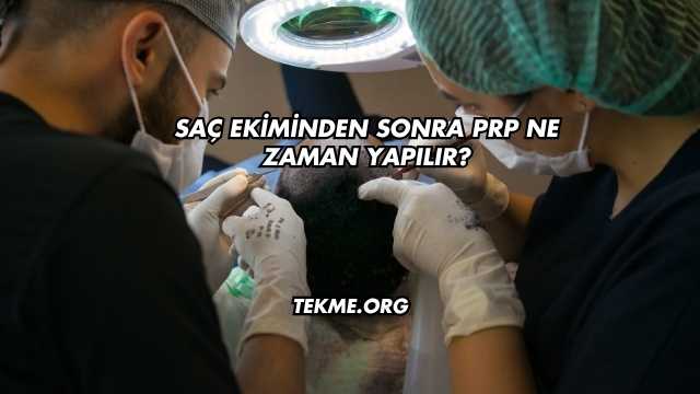 Saç Ekiminden Sonra PRP Ne Zaman Yapılır?