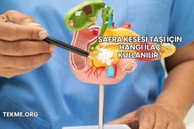 Safra Kesesi Taşı İçin Hangi İlaç Kullanılır?