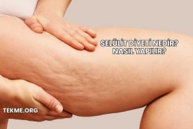 Selülit Diyeti Nedir? Nasıl Yapılır?