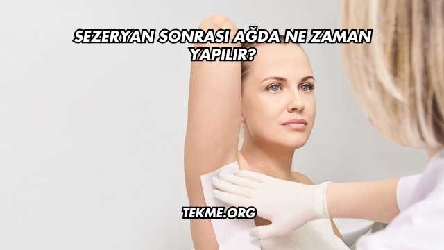 Sezeryan Sonrası Ağda Ne Zaman Yapılır?
