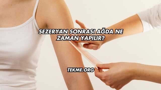 Sezeryan Sonrası Ağda Ne Zaman Yapılır?