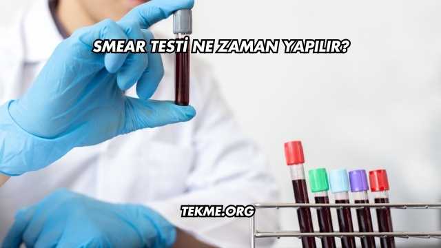 Smear Testi Ne Zaman Yapılır?