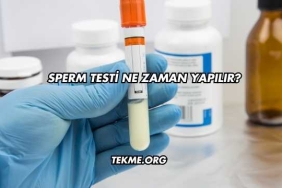 Sperm Testi Ne Zaman Yapılır?