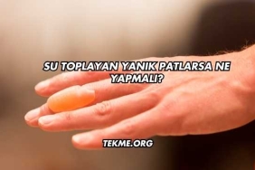Su Toplayan Yanık Patlarsa Ne Yapmalı?