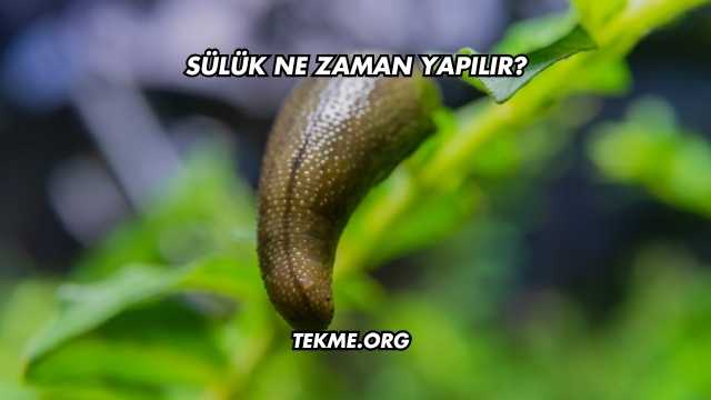 Sülük Ne Zaman Yapılır?