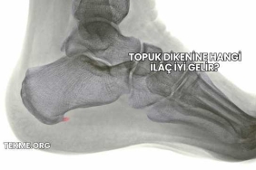 Topuk Dikenine Hangi İlaç İyi Gelir?