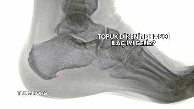 Topuk Dikenine Hangi İlaç İyi Gelir?