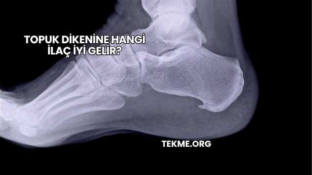 Topuk Dikenine Hangi İlaç İyi Gelir?