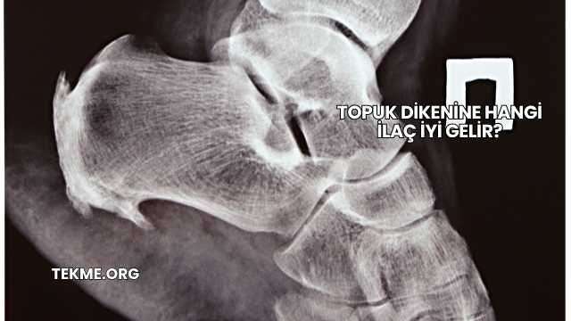 Topuk Dikenine Hangi İlaç İyi Gelir?
