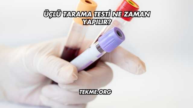 Üçlü Tarama Testi Ne Zaman Yapılır?