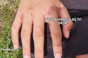 Uyuza Hangi İlaç İyi Gelir?