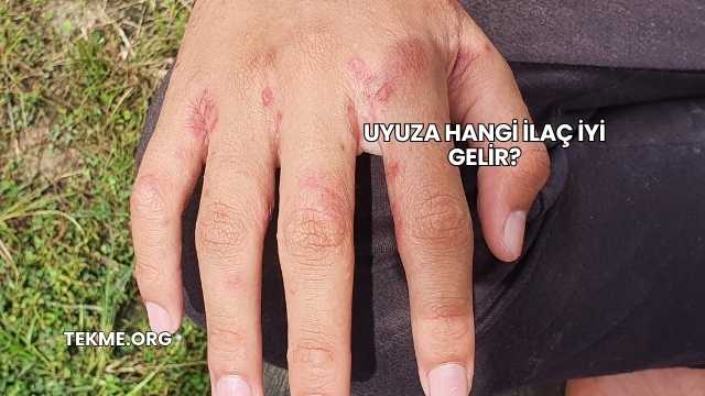 Uyuza Hangi İlaç İyi Gelir?