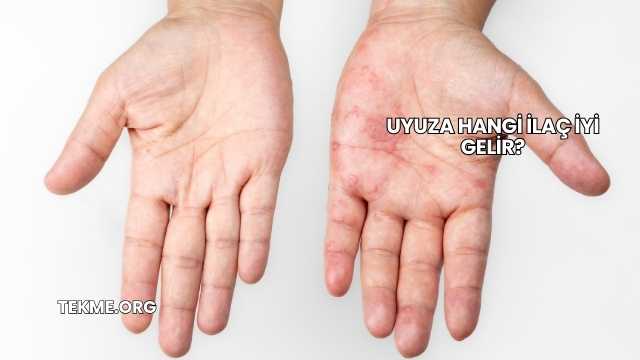 Uyuza Hangi İlaç İyi Gelir?