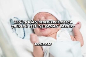 Yeni Doğan Bebeklerde Kalça Çıkıklığı Testi Ne Zaman Yapılır?