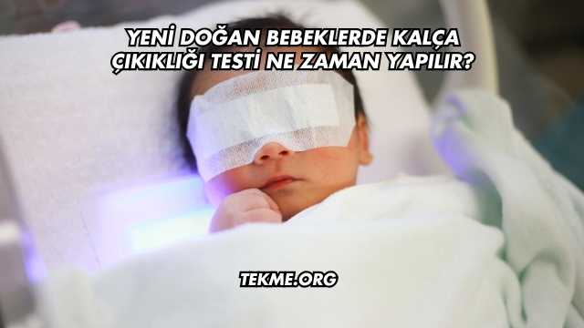 Yeni Doğan Bebeklerde Kalça Çıkıklığı Testi Ne Zaman Yapılır?