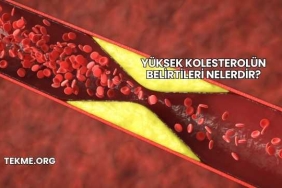 Yüksek Kolesterolün Belirtileri Nelerdir?