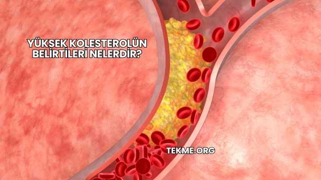 Yüksek Kolesterolün Belirtileri Nelerdir?