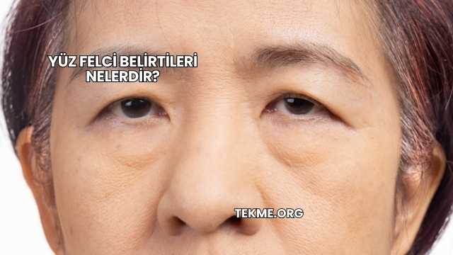 Yüz Felci Belirtileri Nelerdir?