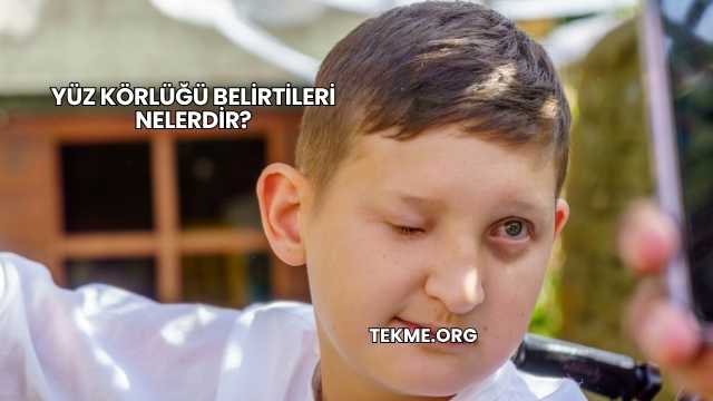 Yüz Körlüğü Belirtileri Nelerdir?