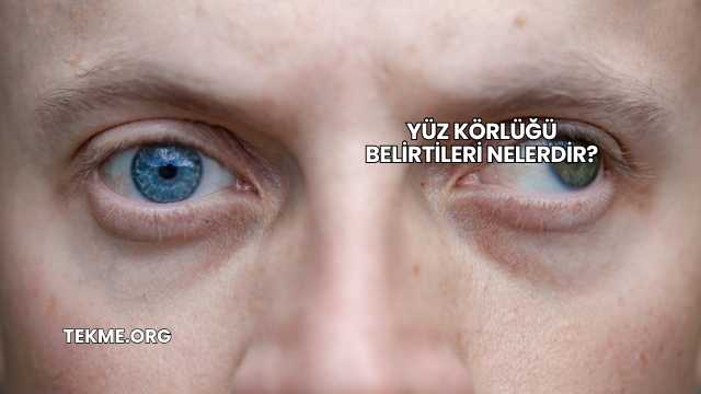 Yüz Körlüğü Belirtileri Nelerdir?