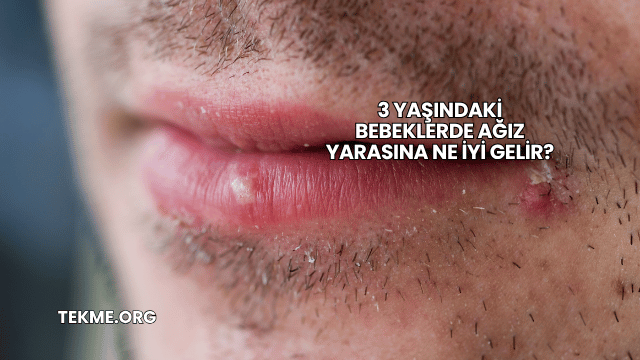 3 Yaşındaki Bebeklerde Ağız Yarasına Ne İyi Gelir?