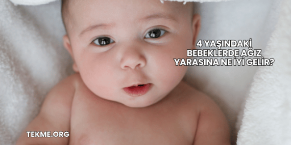 4 Yaşındaki Bebeklerde Ağız Yarasına Ne İyi Gelir?