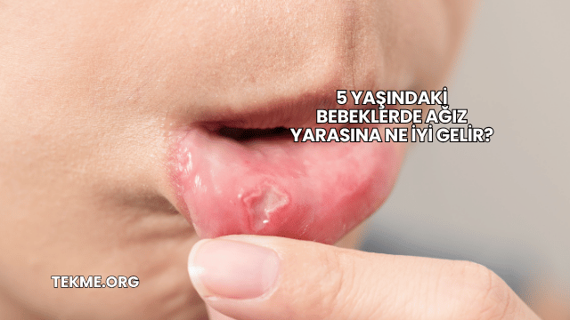 5 Yaşındaki Bebeklerde Ağız Yarasına Ne İyi Gelir?