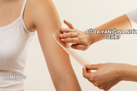 Ağda Yanığına Ne İyi Gelir?
