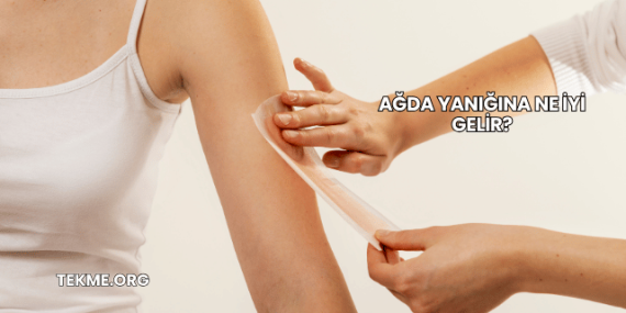 Ağda Yanığına Ne İyi Gelir?
