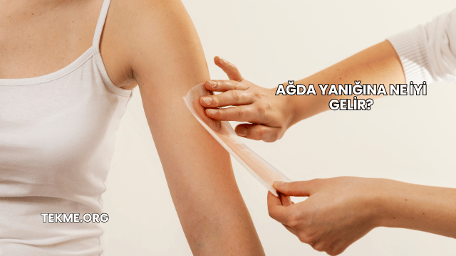 Ağda Yanığına Ne İyi Gelir?