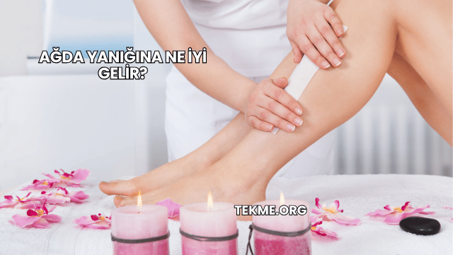 Ağda Yanığına Ne İyi Gelir?