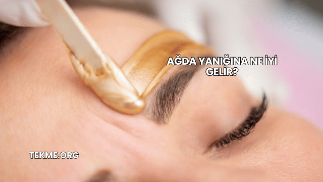 Ağda Yanığına Ne İyi Gelir?
