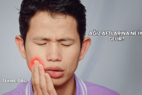 Ağız Aftlarına Ne İyi Gelir?
