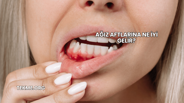 Ağız Aftlarına Ne İyi Gelir?